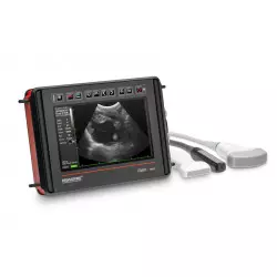 Wielofunkcyjny ultrasonograf Dramiński iScan2 MULTI (bez sondy)